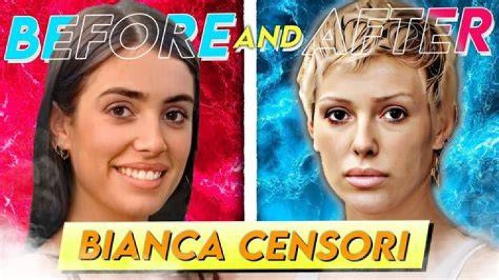Bianca Censori Implants: A Comprehensive Guide to Understanding the Procedure and Its Implications