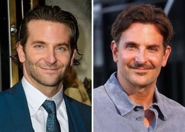 Bradley Cooper Face Lift: The Truth Behind the Rumors and Procedures