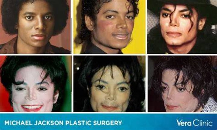 Don Johnson's Evolution: The Truth Behind His Plastic Surgery Journey