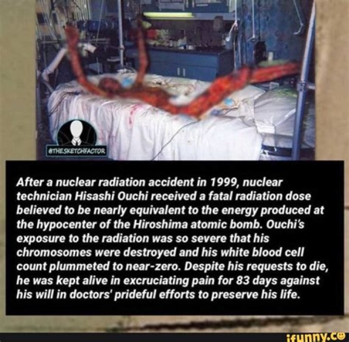 Hisashi Ouchi Hospital Picture: A Journey Through Tragedy and Hope