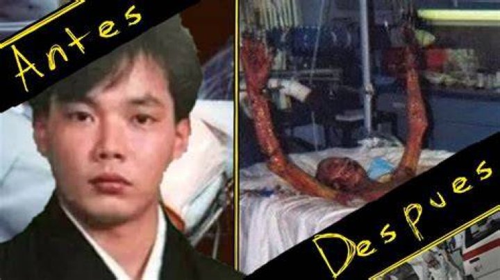 Hisashi Ouchi: The Man Behind the Tragic Photos and His Story