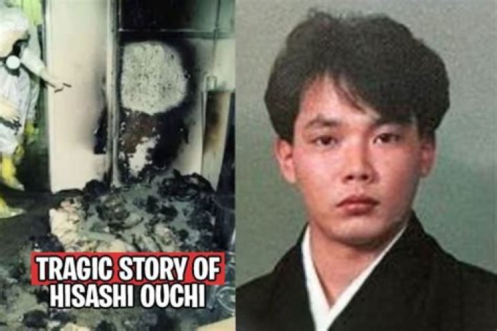 Hisashi Ouchi: The Tragic Story Behind the Radiation Photo