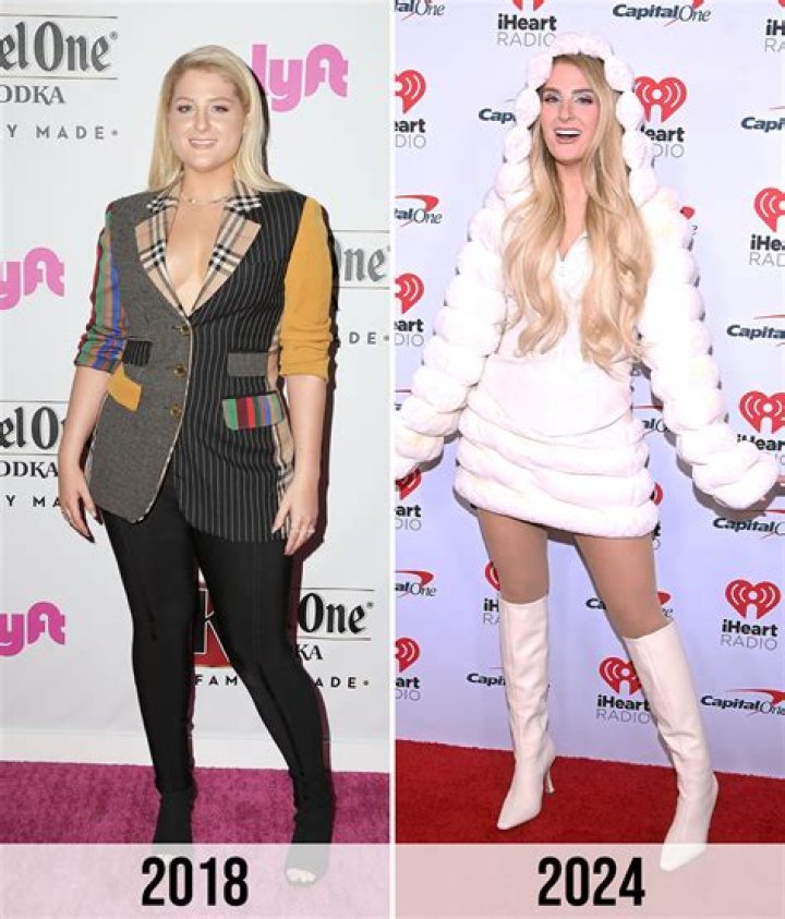 Meghan Trainor's Son Condition: A Journey of Love and Resilience