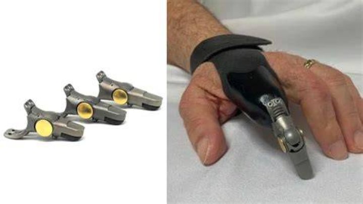 Revolutionizing Mobility: Exploring the Art and Science of Point Design Prosthetics