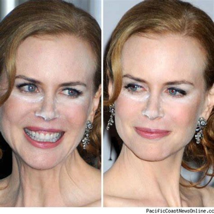 Stunning Nicole Kidman Face: Timeless Beauty Secrets