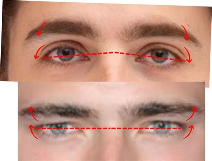 Understanding Hunter Eyes: The Fascinating Phenomenon Behind This Unique Eye Trait