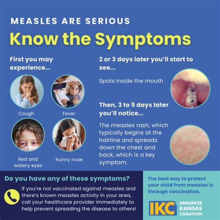 Understanding the Risks of Measles Exposure at Dulles Airport