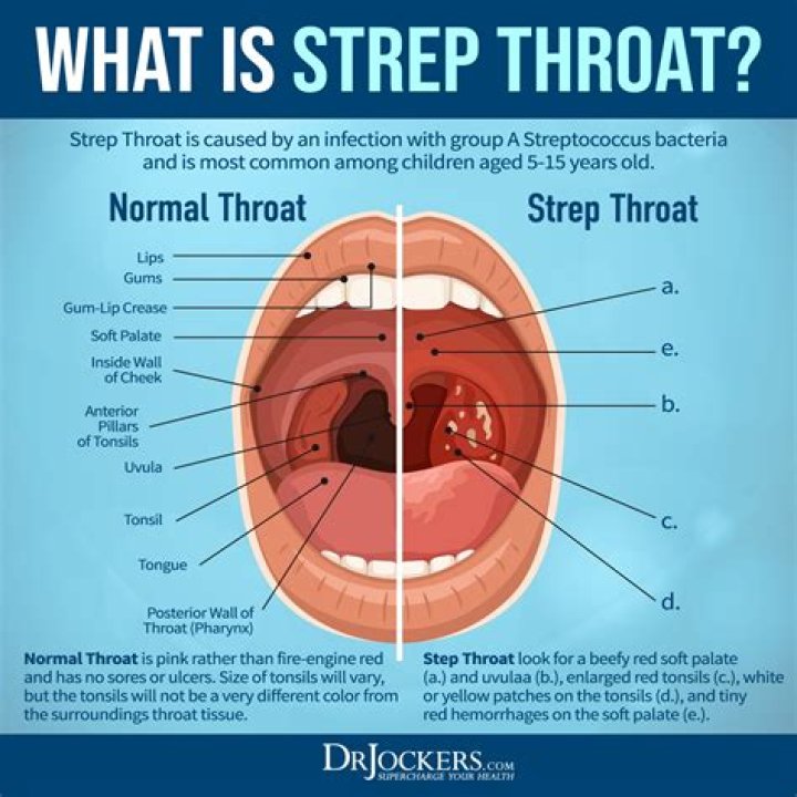 Understanding Throat Baby Ari: An In-Depth Guide to Causes, Symptoms, and Treatments