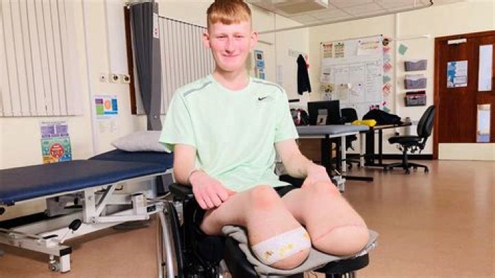 Unraveling the Truth: Did Richard Thomas Have His Leg Amputated?