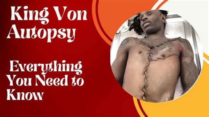 Unraveling the Truth: King Von Autopsy Released