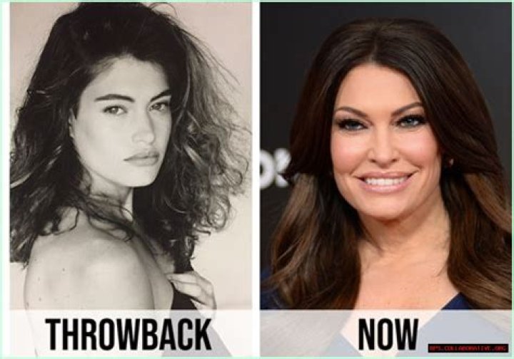 Unveiling the Transformation: Kimberly Guilfoyle Before and After